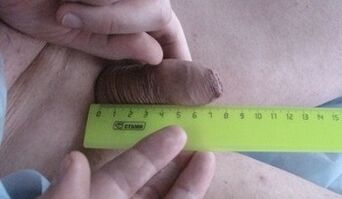 Misurazione delle dimensioni del pene